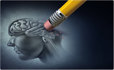Alzheimer's
