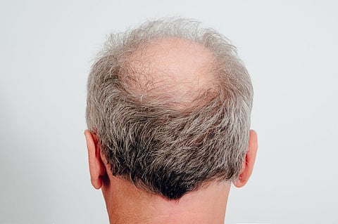 Bald