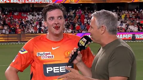 Jhye Richardson Celebrate Perth Scorchers 4th BBL Championship with bleeding Nose