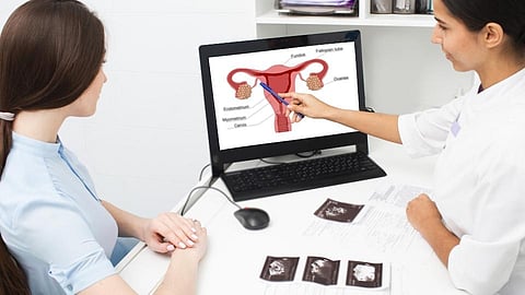 endometriosis
