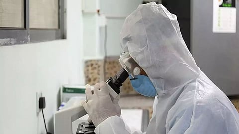 Corona virus alters proteins in the sperm cells thereby affecting fertility