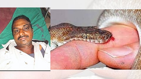 Snake bite
