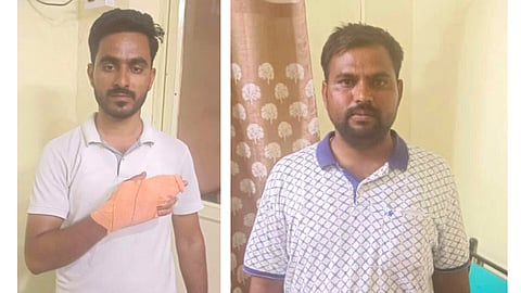 Police Injured