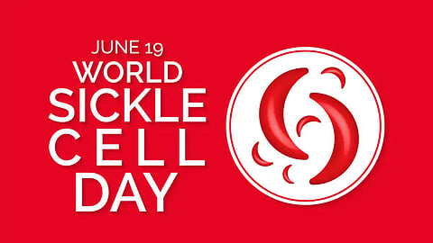 Health world sickle cell day 2022