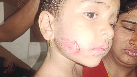 pig attacked child