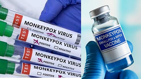 Monkeypox: लस तयार करण्यासाठी सीरम, भारत बायोटेक यांच्यात स्पर्धा