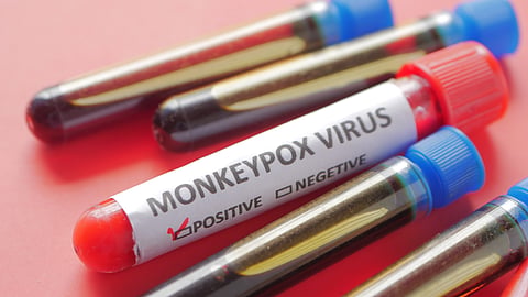 Delhi Monkeypox Latest News