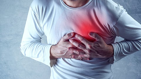 Heart attack