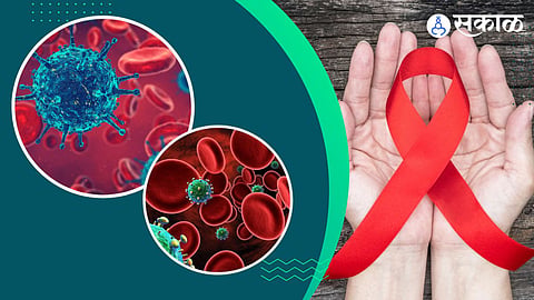 HIV AIDS Symptoms