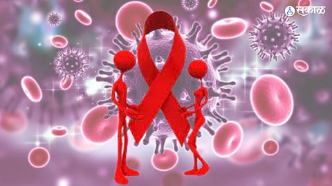 HIV Aids Symptoms