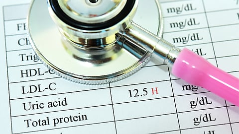 Uric Acid