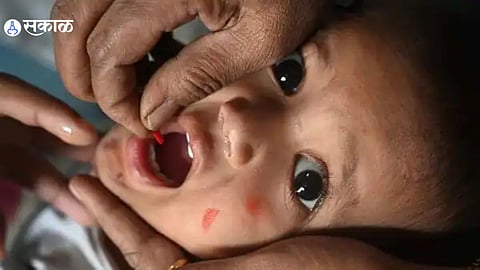 Measles Disease