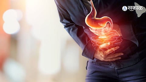 Stomach Gas Relief
