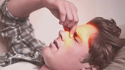 Fungal Sinusitis