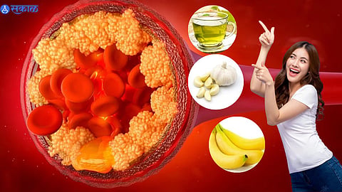 Bad Cholesterol