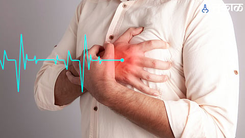 Heart Attack