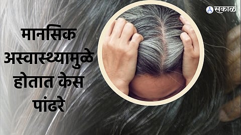 White Hair Problem