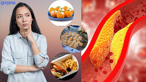 High Cholesterol