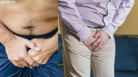 UTI In Men