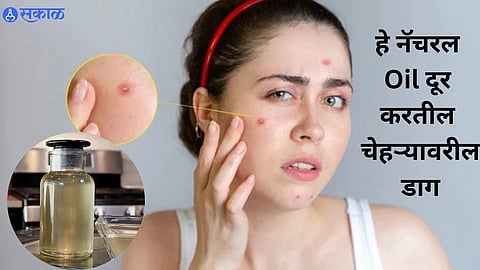 Skin Care