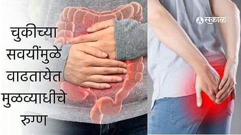 Piles Health Tips