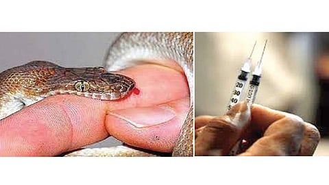 Snakebite