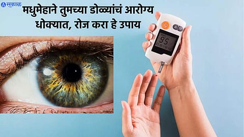 Diabetic Patient Eye Care