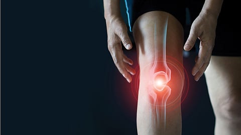 Healthy joints