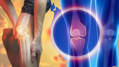 Bone Cancer
