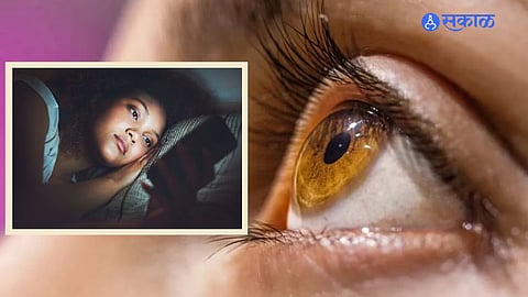 Smartphone Vision Syndrome