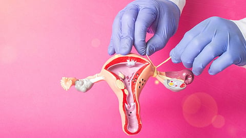 Avoid Pregnancy