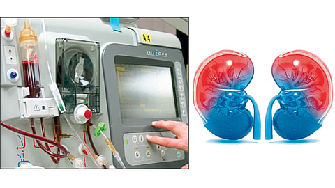 Dialysis