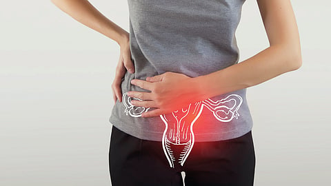 Period Problem