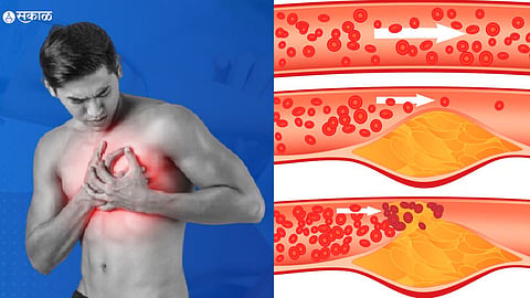 Cholesterol Level In Male