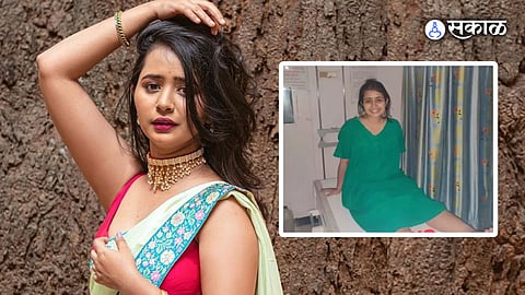 Aai Kuthe Kay Karte actress Gauri Kulkarni suffers leg injury after meeting with an accident