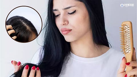 Hair Fall Solution