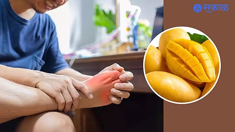 Mango In Uric Acid