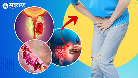 how to stop frequent urination naturally