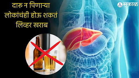 World Liver Day
