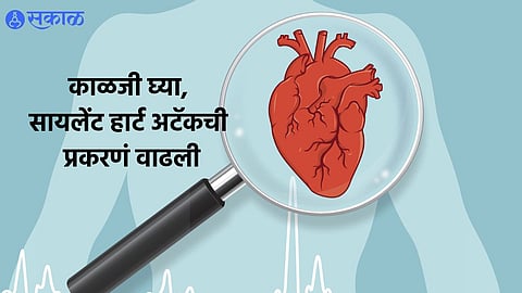 Heart attack