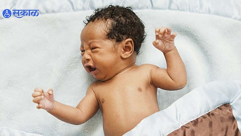 Premature births increased India preterm babies Premature Birth Complications Management Causes