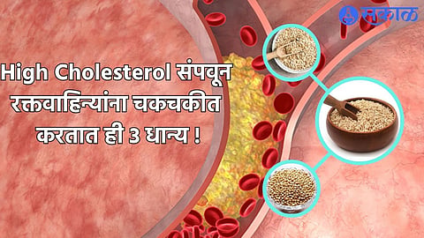 High Cholesterol Foods