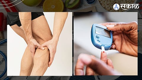 diabetes symptoms