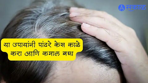 White Hair Problem