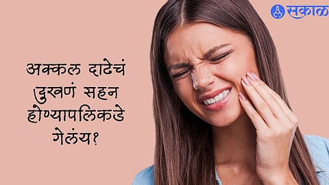 Wisdom Tooth Pain