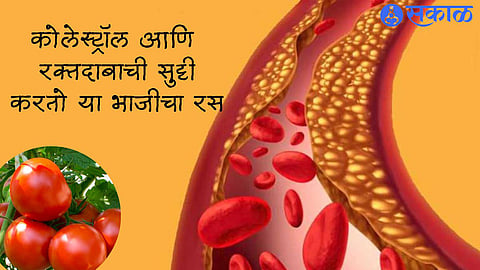 Best Food For High Cholesterol