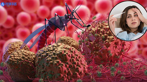 Dengue Fever