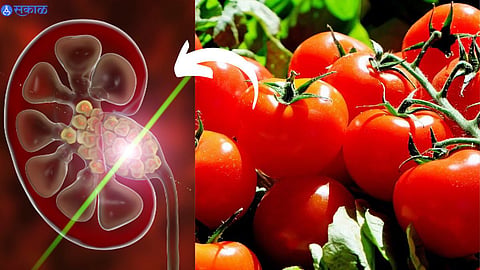 Tomato Side Effect