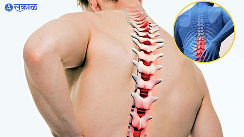 Mumbai Rise in Spinal Injury Complaints Various diseases due to pits bad road road accident traffic police