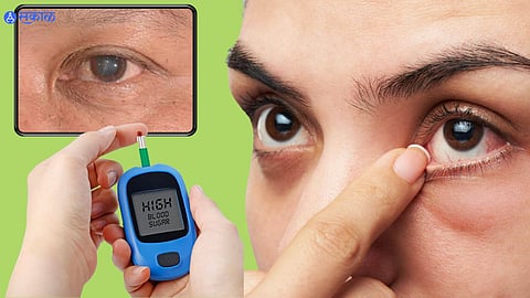 Diabetes Symptoms